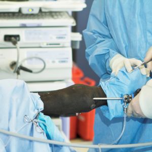 Key Hole Surgery